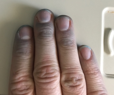 watch out for the free socks